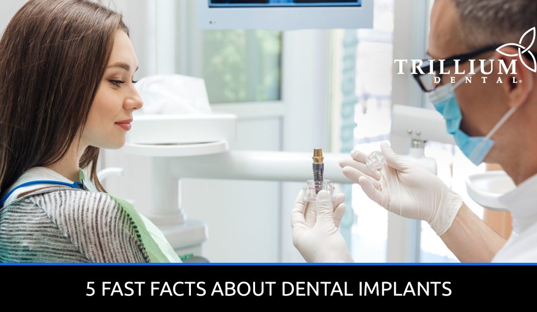 5 FAST FACTS ABOUT DENTAL IMPLANTS