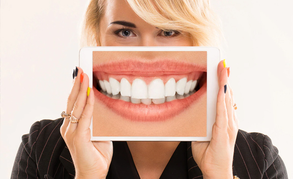 Denture-Replacement- General Dentistry Ottawa