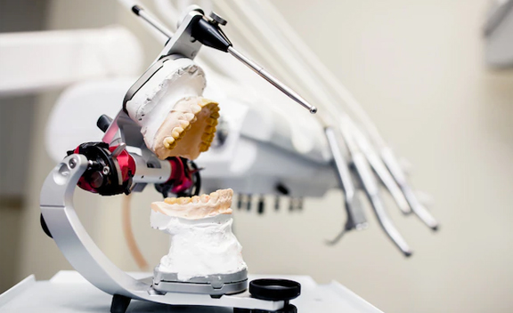 Implant-Retained-Dentures- Restorative Dentistry Ottawa