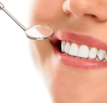 Teeth Whitening Ottawa