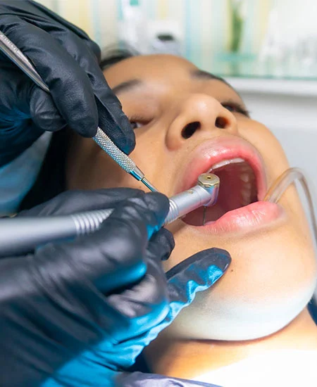 Prevent Cavities & Tooth Decay Prevent Cavities & Tooth Decay