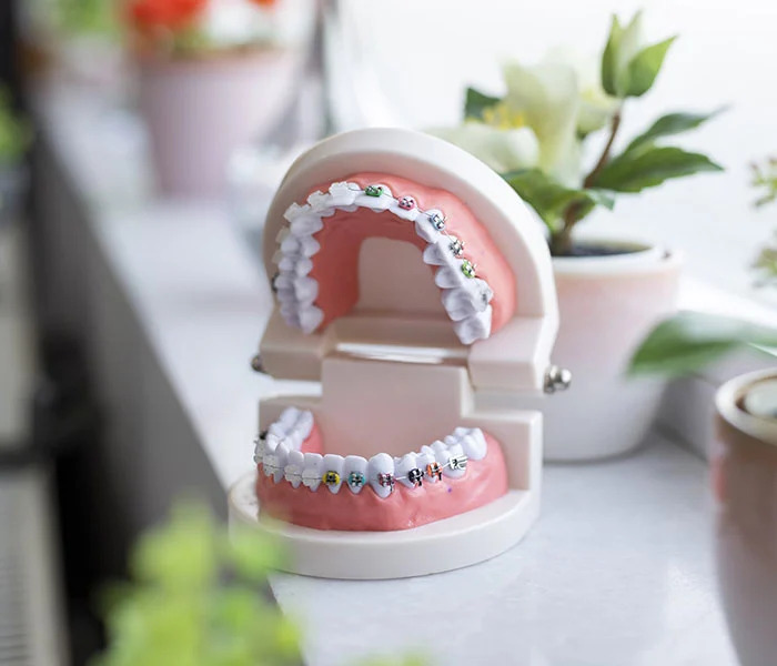 Invisalign in Nepean