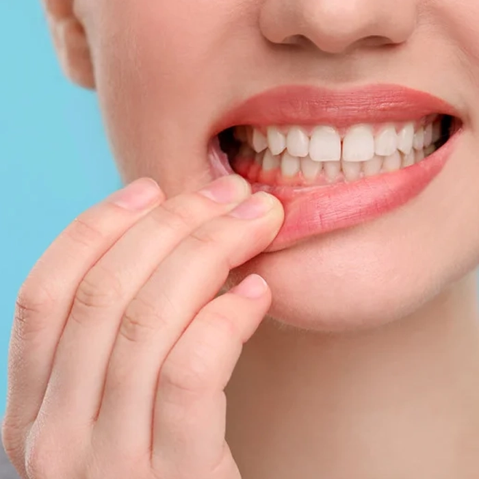 Periodontics Ottawa