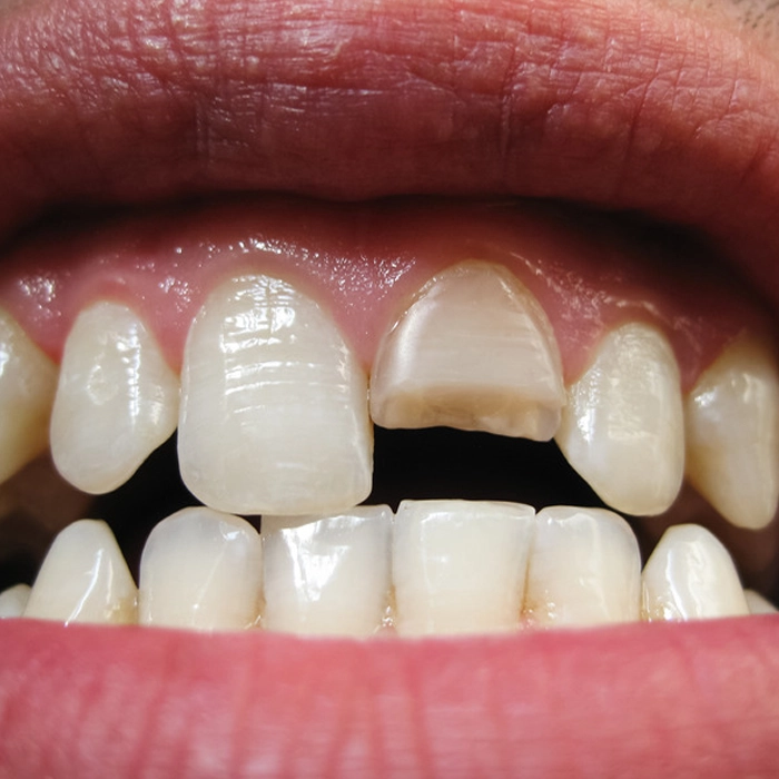 Cosmetic Dentistry Ottawa