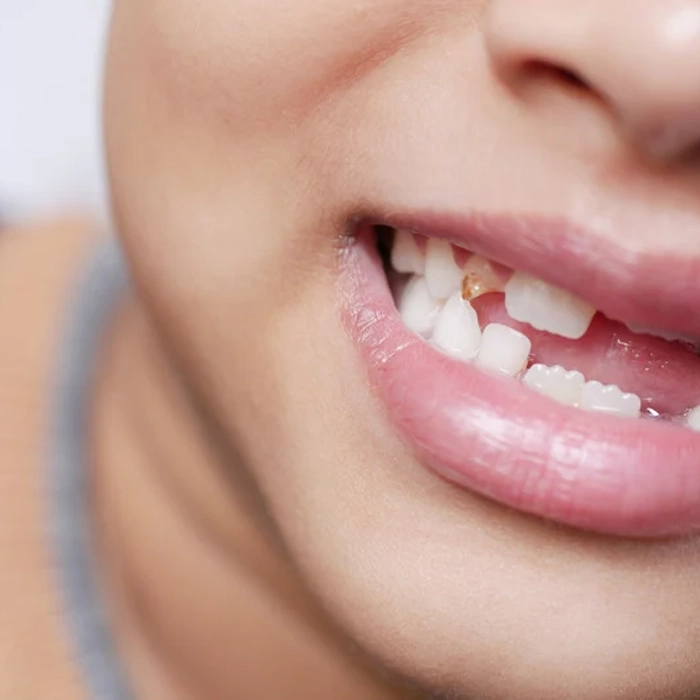 General Dentistry Ottawa