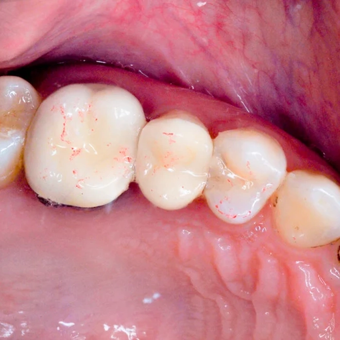 Periodontics Ottawa