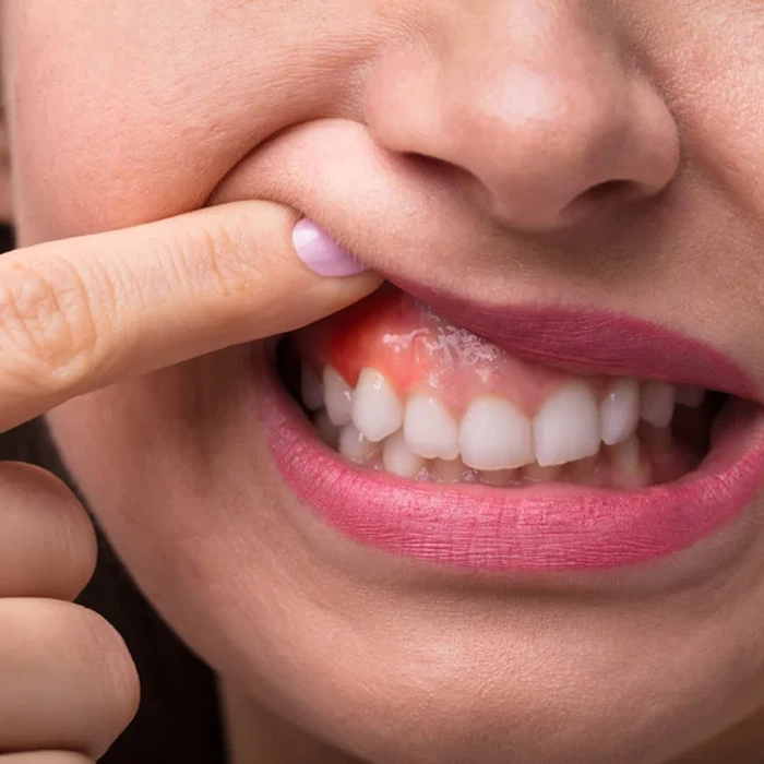 Cosmetic Dentistry Ottawa