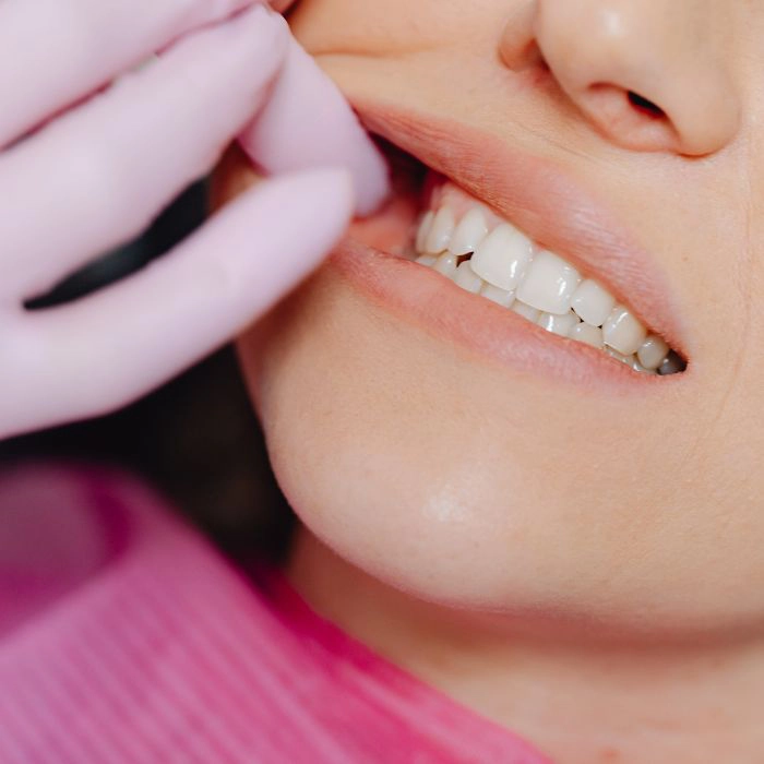 Cosmetic Dentistry Ottawa
